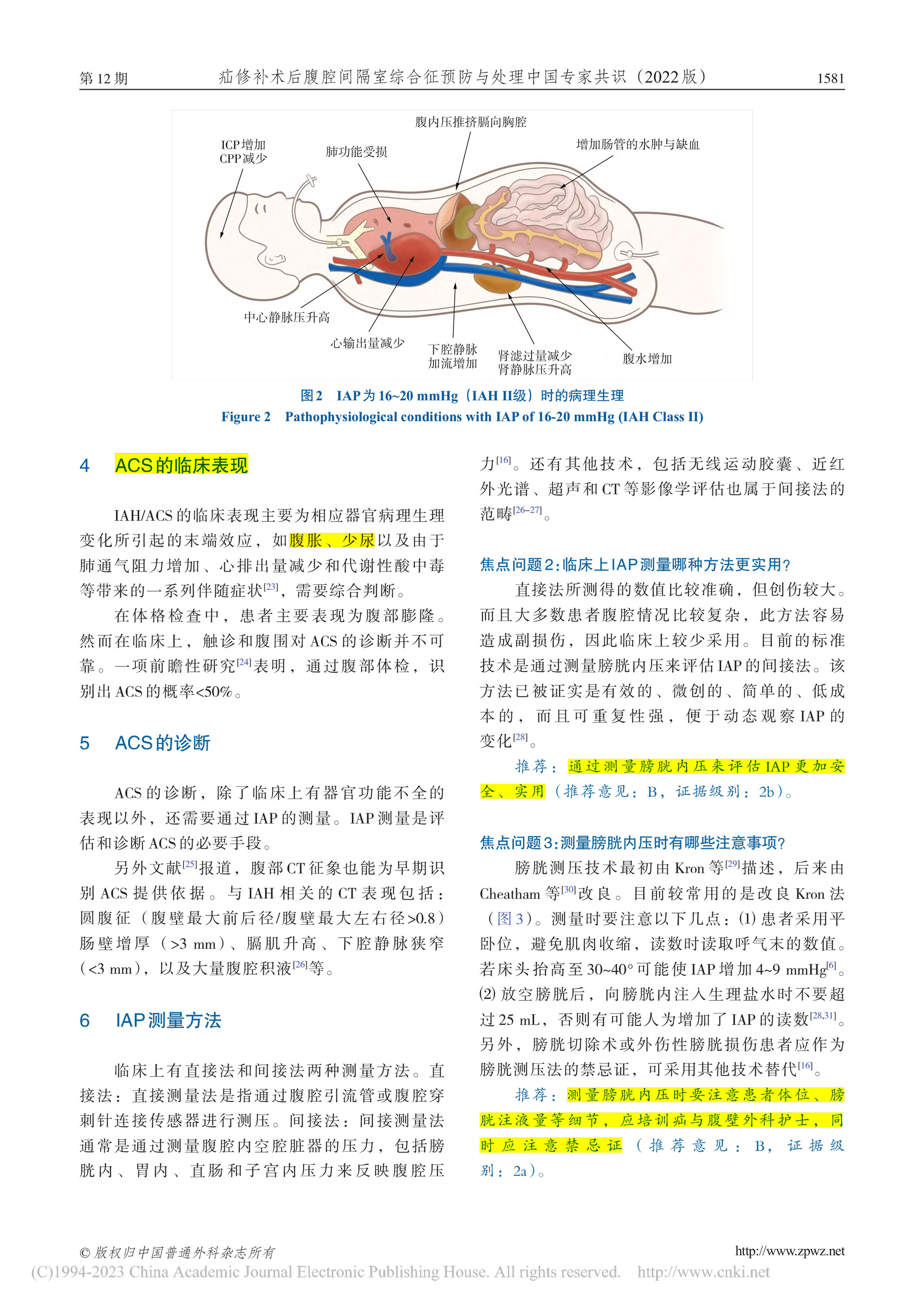 2022-疝修补术后腹腔间隔室综合征预防与处理中国专家共识-4.jpg